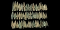 Greek Tri-Finned Arrowhead Collection