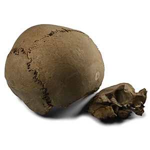 Anglo-Saxon Human Cranium and Fragments