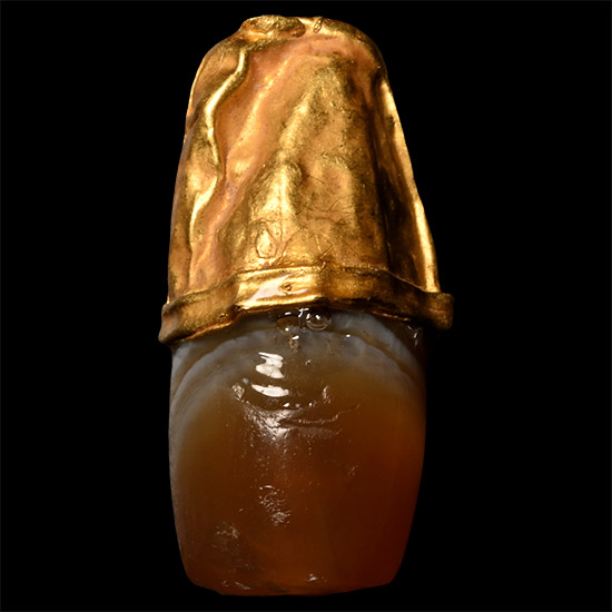 Western Asiatic Gold Capped Banded Agate Bead