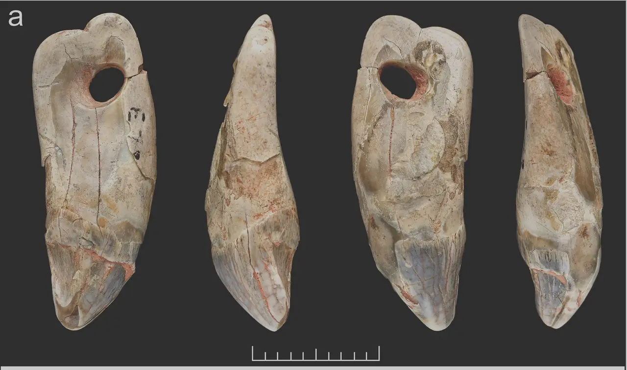 tooth angles
