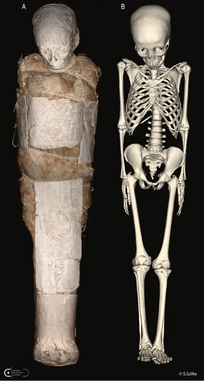 skeleton