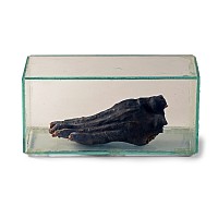 Foot of an Egyptian Mummy