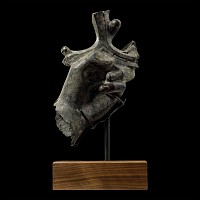 Roman Bronze Hand Holding a Parazonium