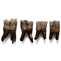 Set of Woolly Rhinoceros Teeth