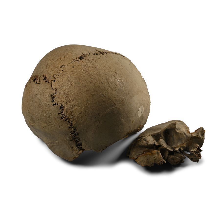 Anglo-Saxon Human Cranium and Fragments