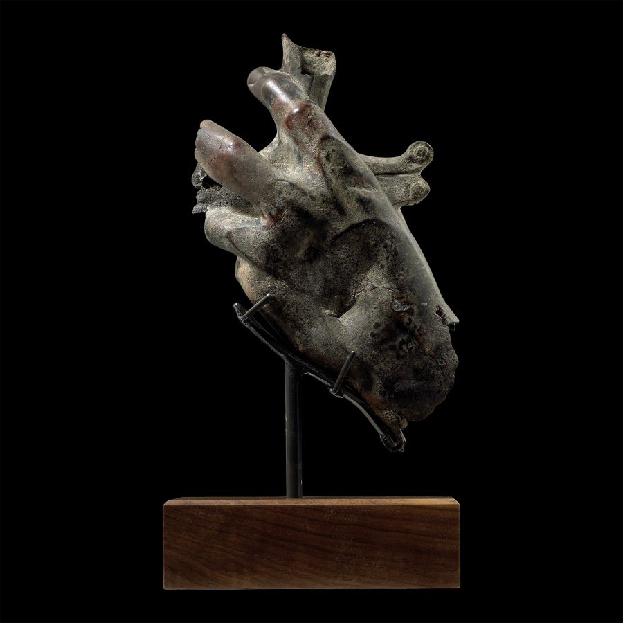 Roman Bronze Hand Holding a Parazonium